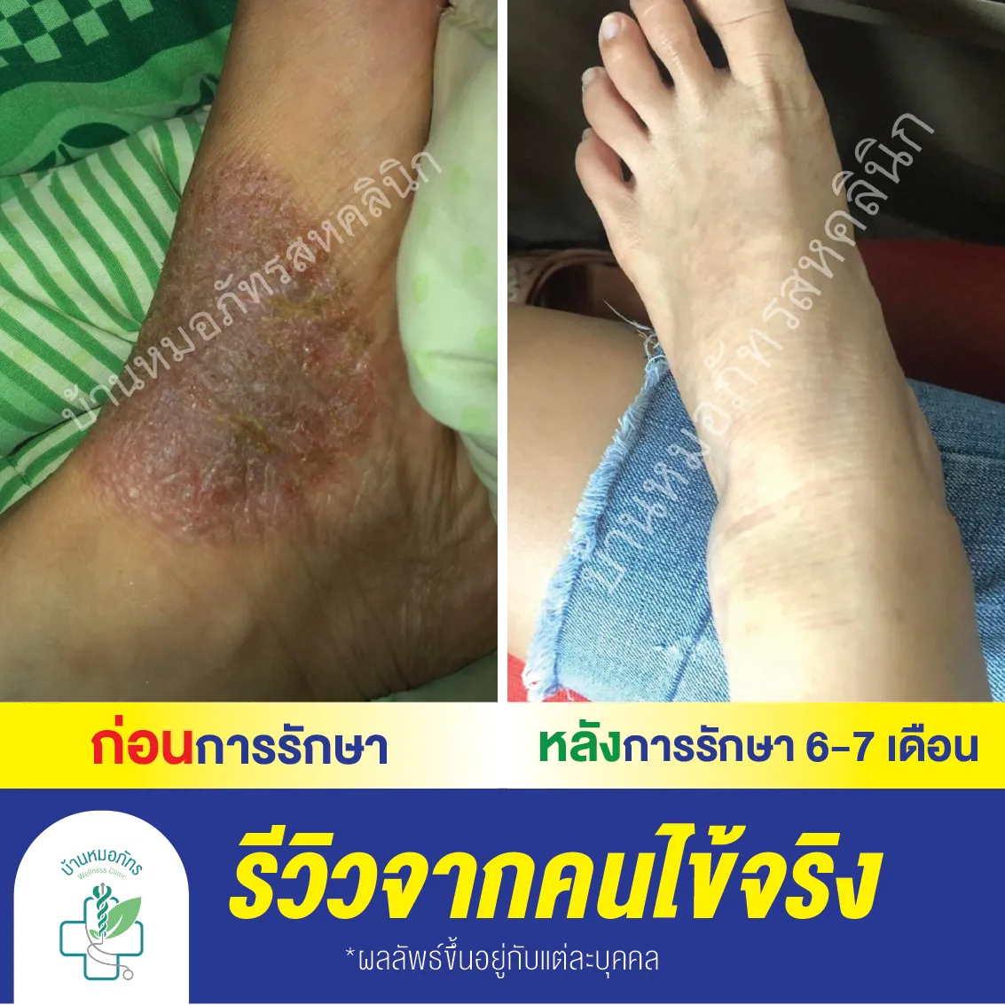 รีวิวล่างน้ำเงิน-07