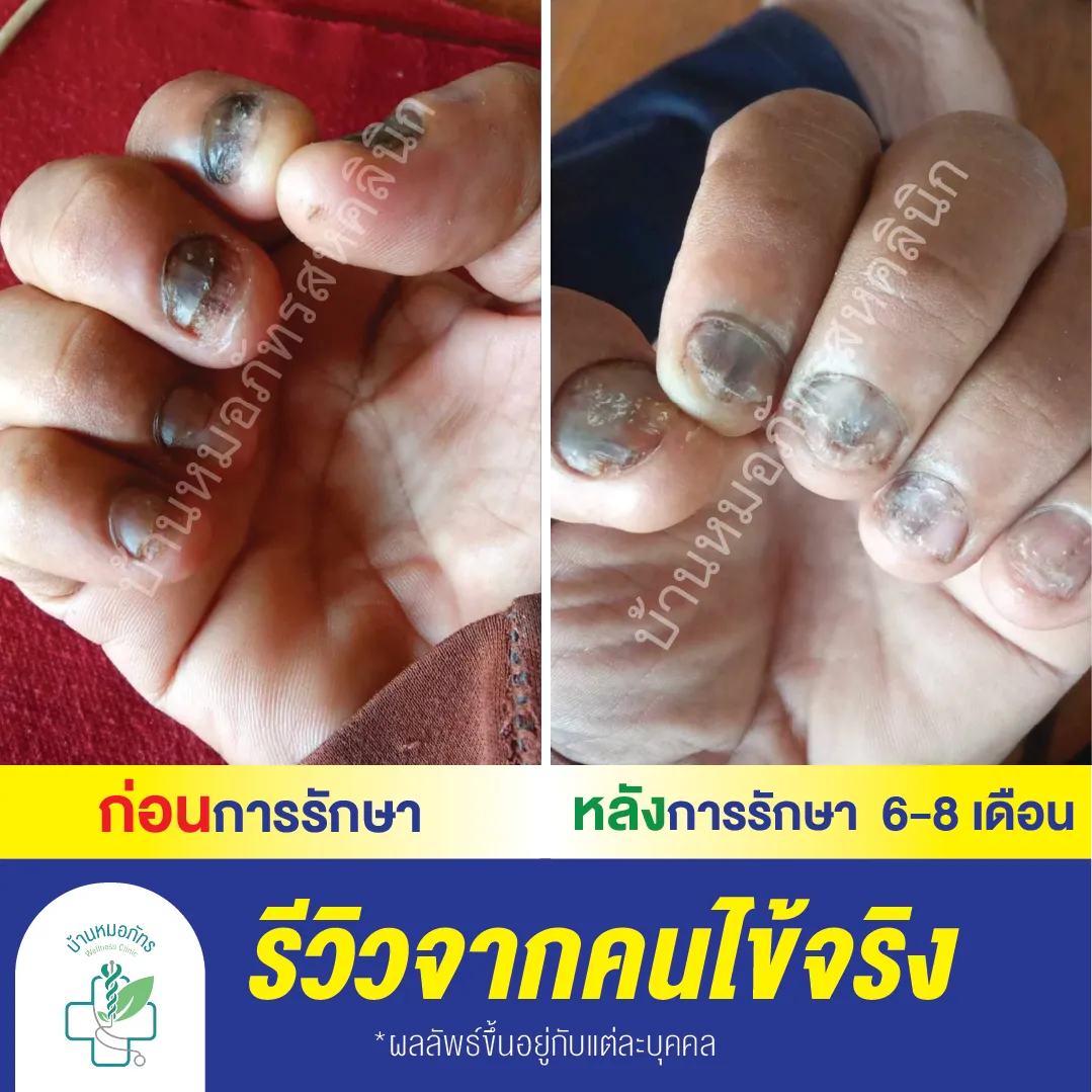 รีวิวล่างน้ำเงิน-103
