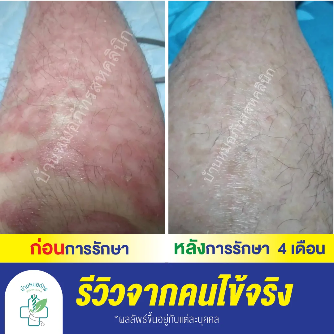 รีวิวล่างน้ำเงิน-115