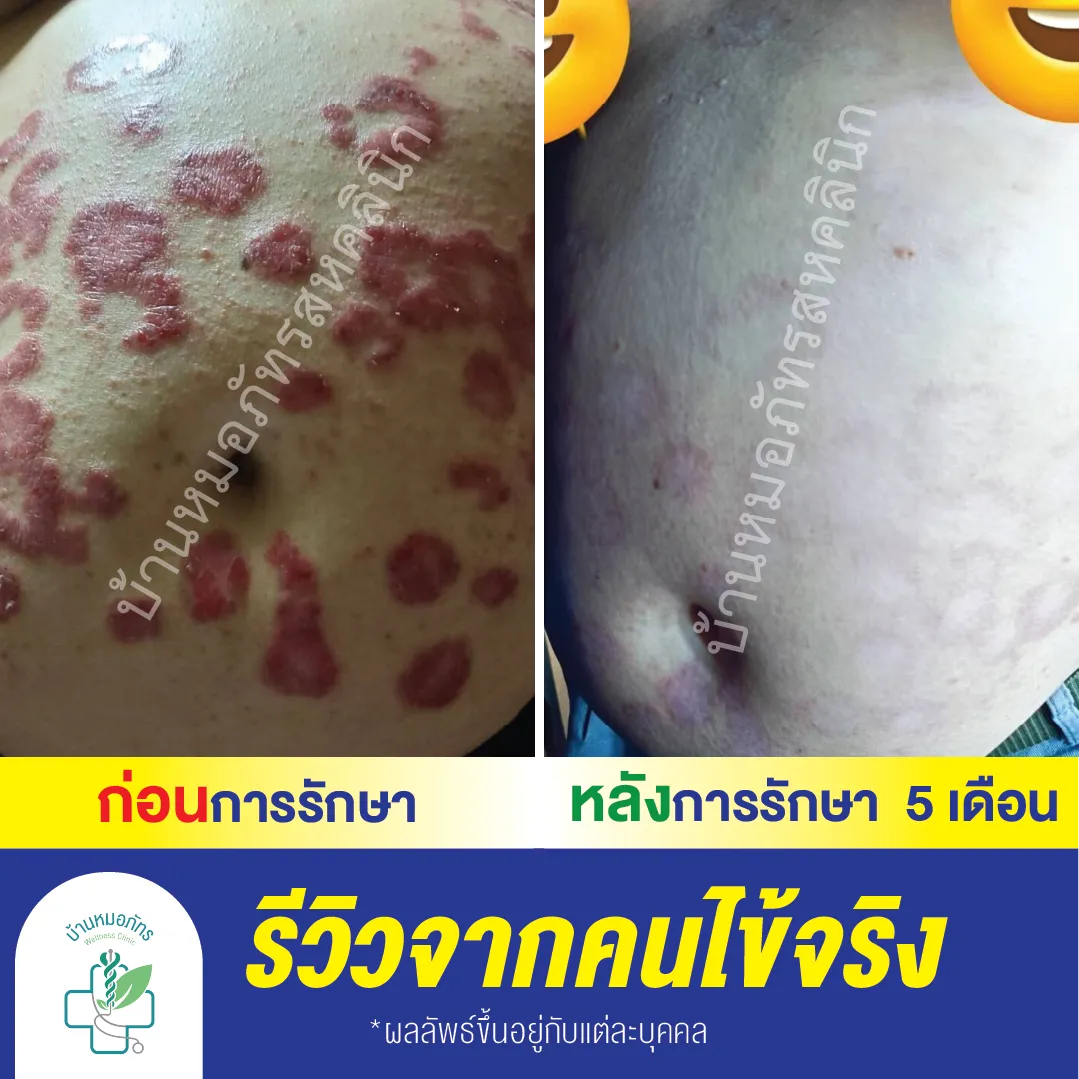 รีวิวล่างน้ำเงิน-118