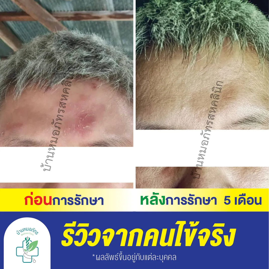 รีวิวล่างน้ำเงิน-127