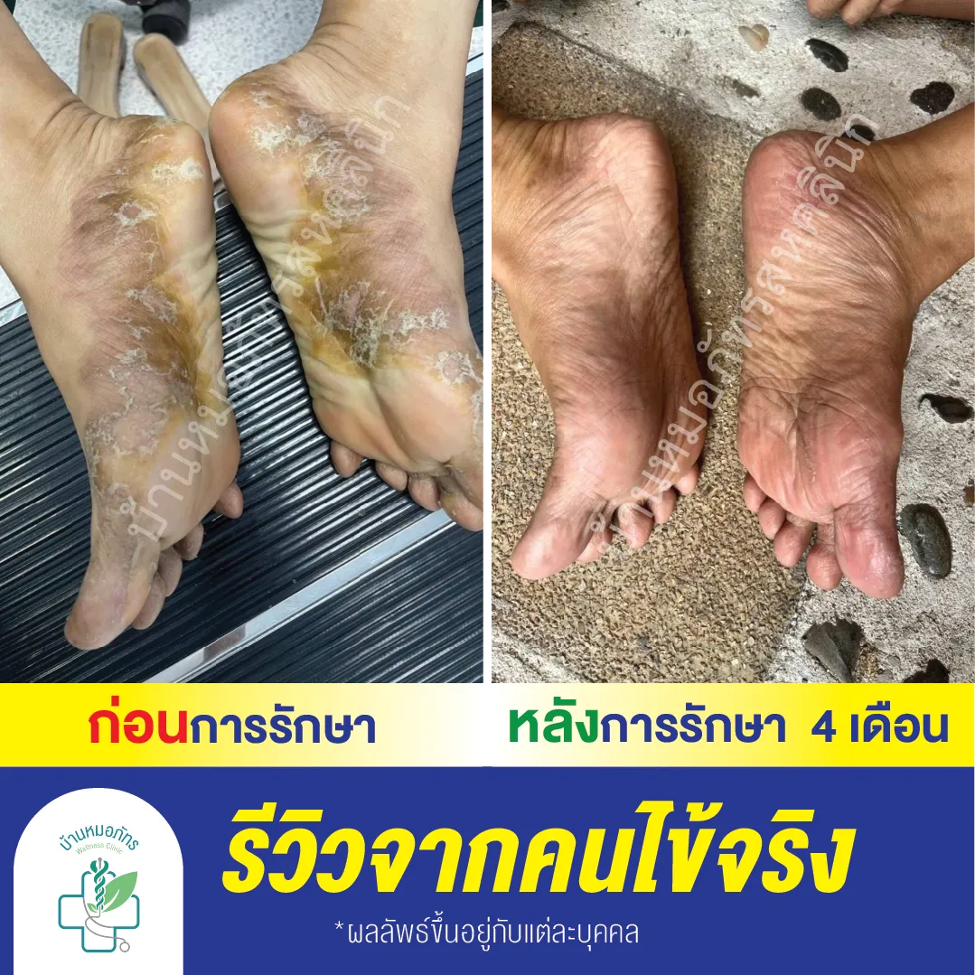รีวิวล่างน้ำเงิน-130