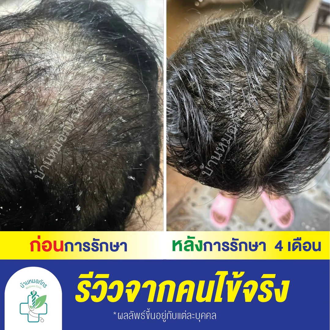รีวิวล่างน้ำเงิน-133