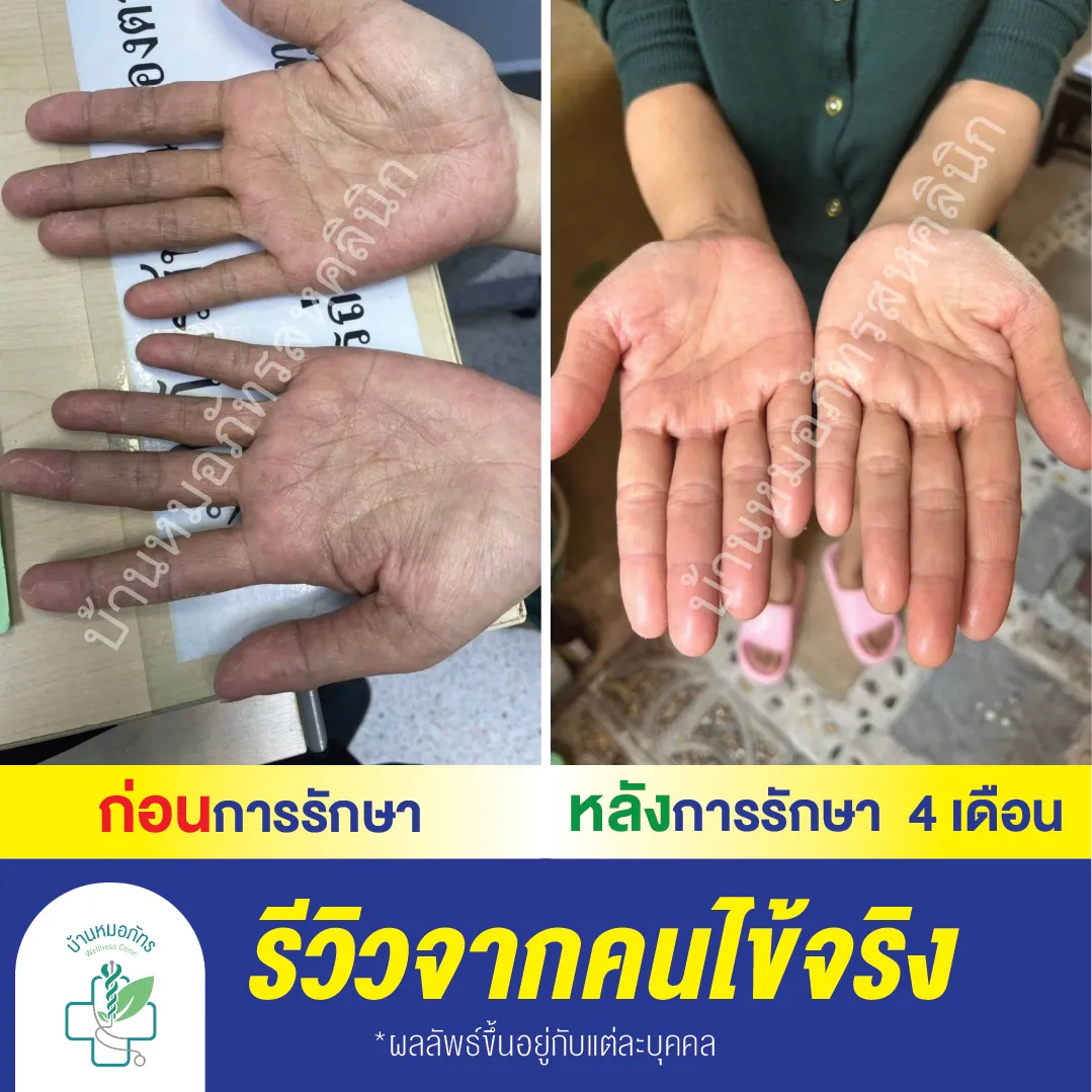 รีวิวล่างน้ำเงิน-136