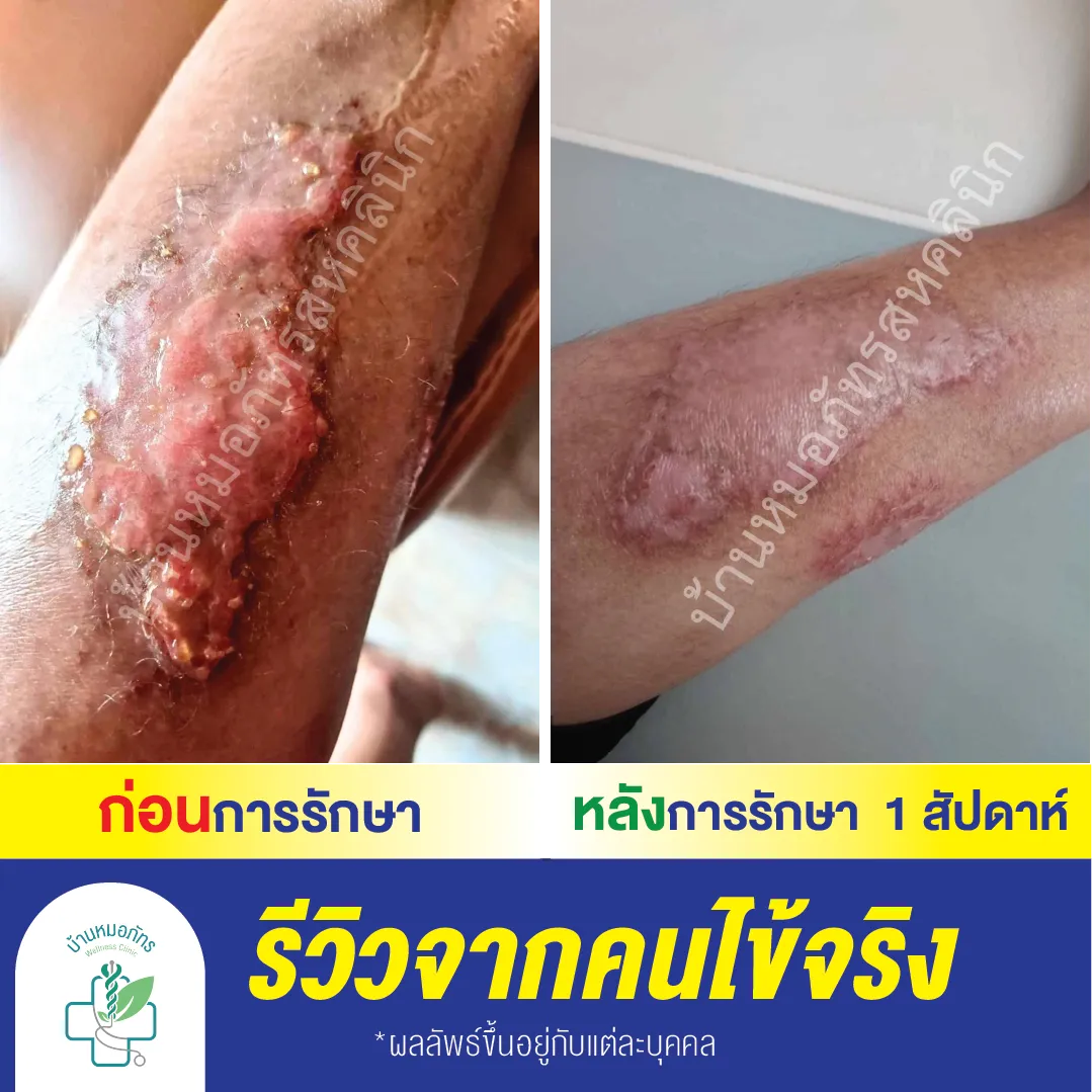 รีวิวล่างน้ำเงิน-58