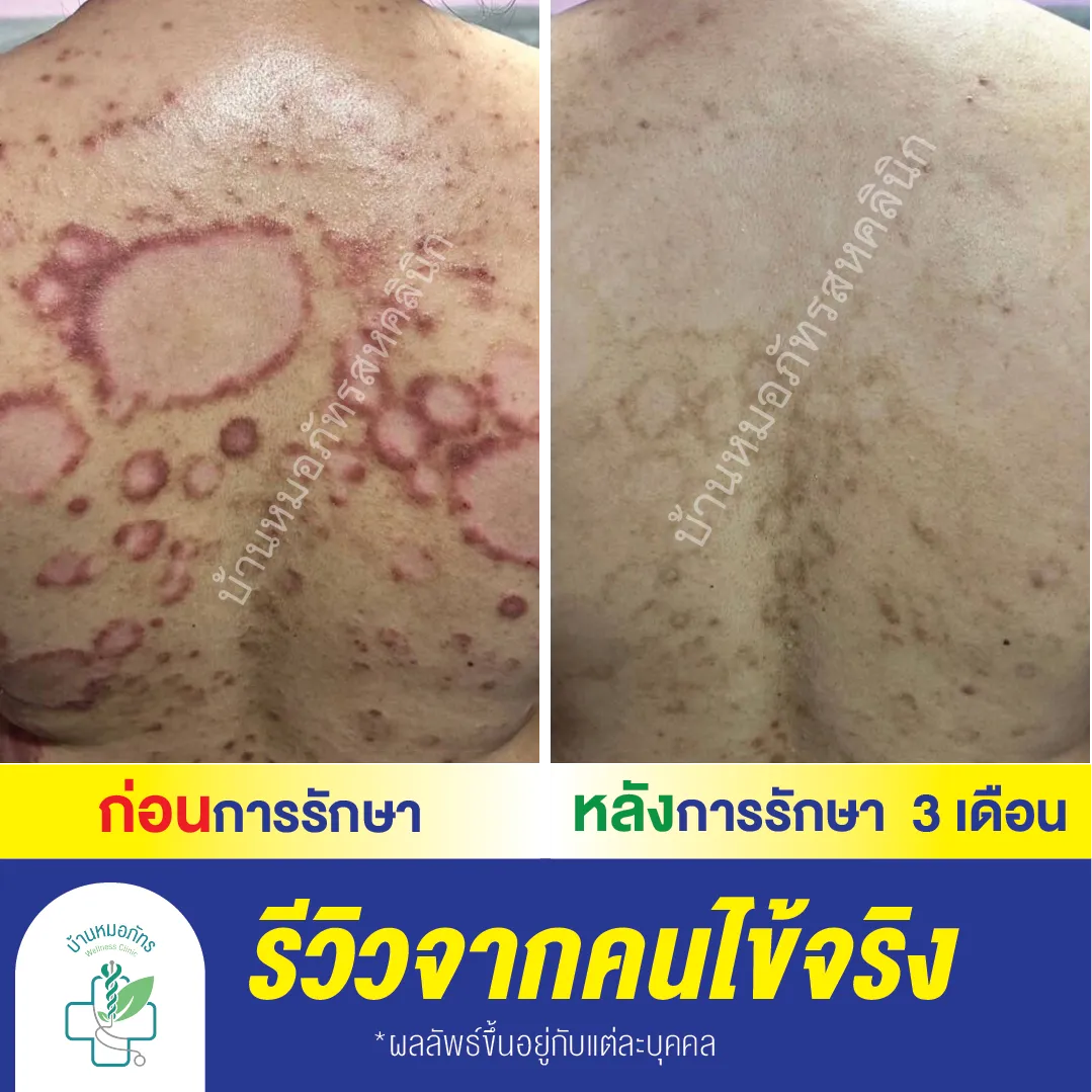 รีวิวล่างน้ำเงิน-61