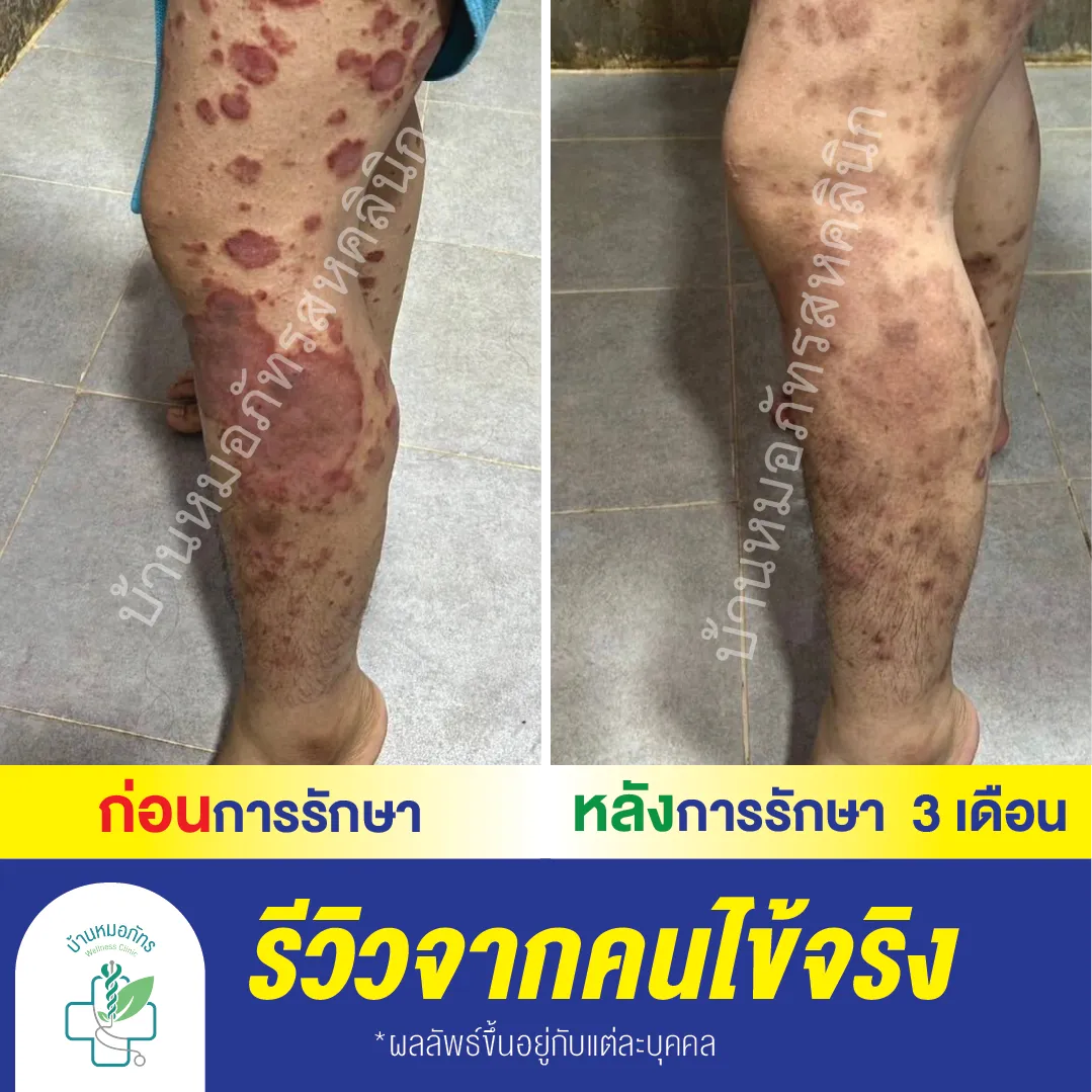 รีวิวล่างน้ำเงิน-64