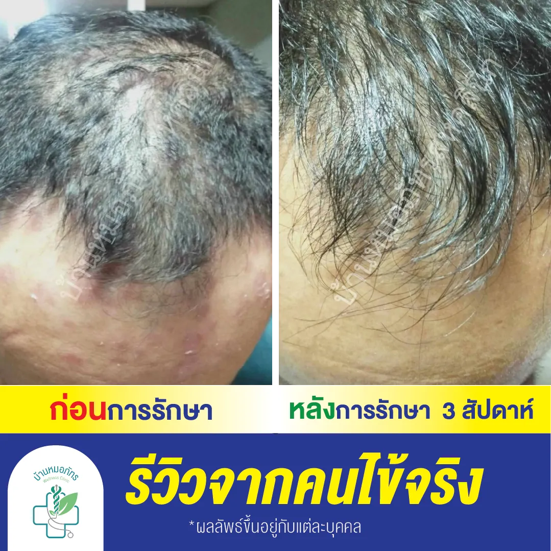 รีวิวล่างน้ำเงิน-73