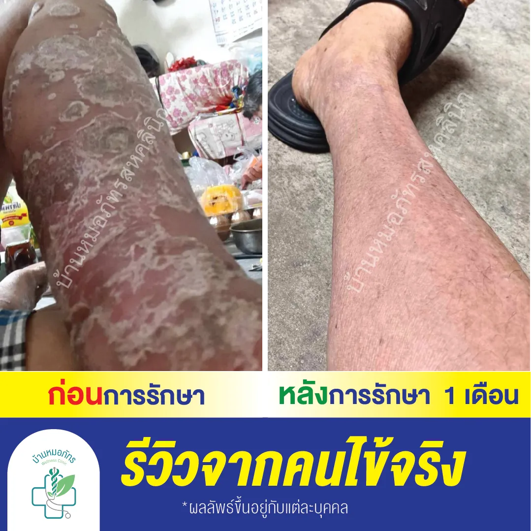 รีวิวล่างน้ำเงิน-85