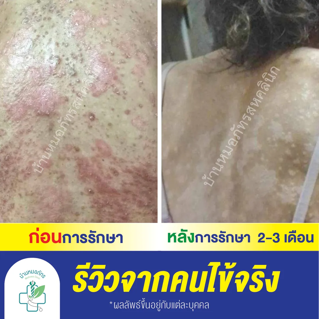 รีวิวล่างน้ำเงิน-91