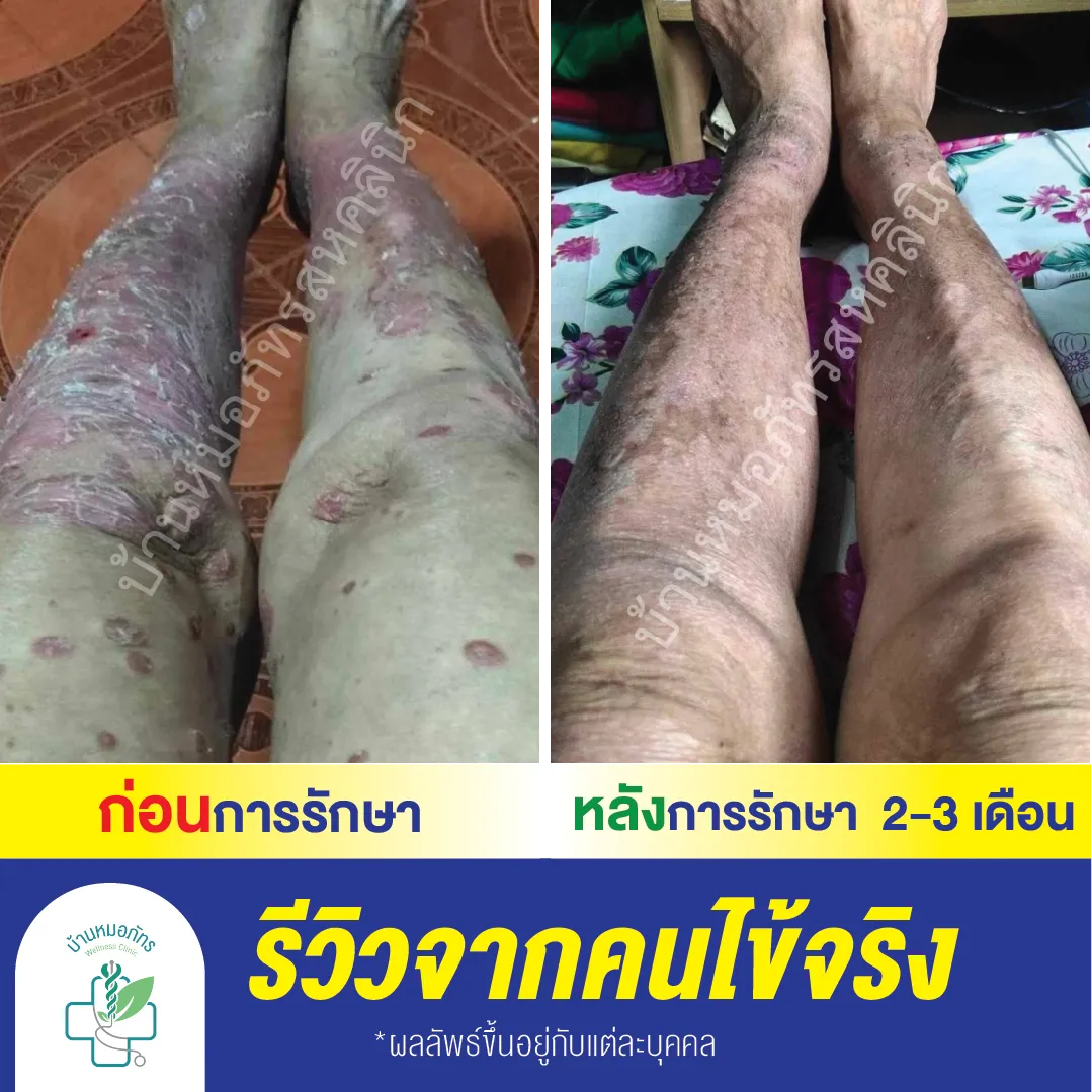 รีวิวล่างน้ำเงิน-94