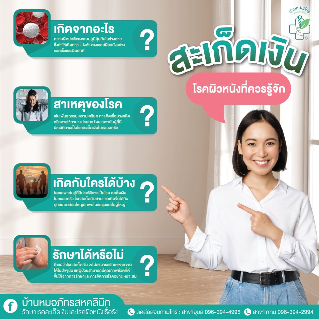 สะเก็ดเงินโรคผิวหนังที่ควรรู้จัก
